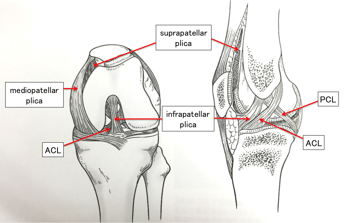 ひだ 障害 膜 滑 【膝の痛み】滑膜ひだ障害（タナ障害）の症状・原因・治療まとめ
